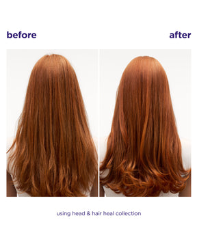 Head & Hair Heal Conditioner Liter